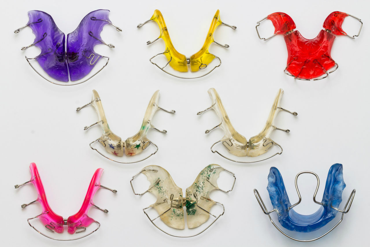 изготовление каппы в стоматологии