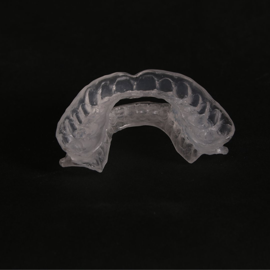 каппа ортодонтическая после брекетов