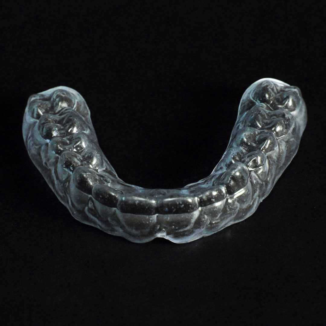 каппа после снятия брекетов цена